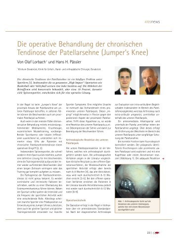 Die operative Behandlung der chronischen Tendinose der ...