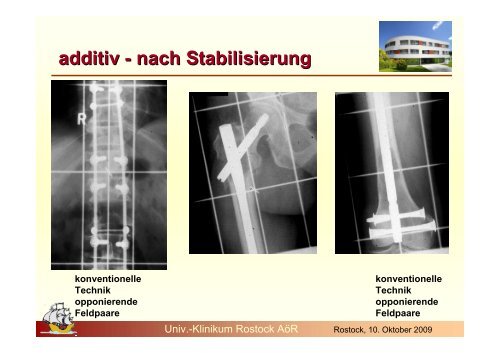 palliative Therapie - Strahlentherapie