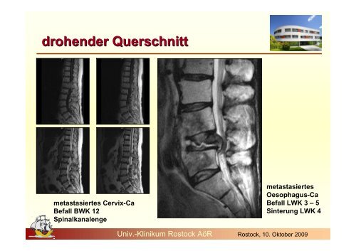 palliative Therapie - Strahlentherapie