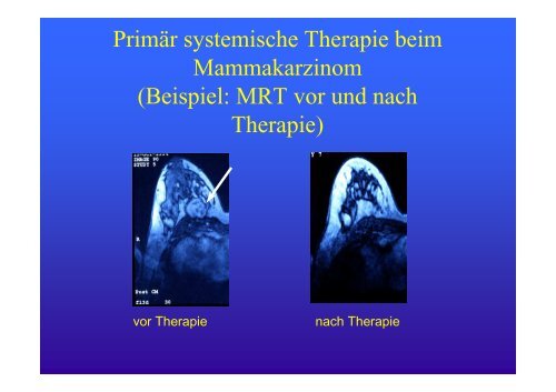 Heilungschance oder Chemiekeule? - Chemotherapie und ...