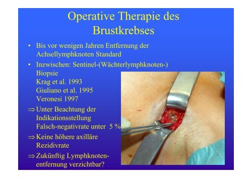 Heilungschance oder Chemiekeule? - Chemotherapie und ...