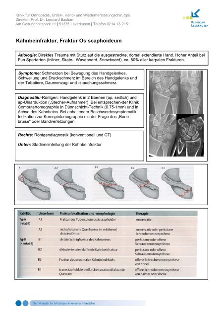 Kahnbeinfraktur, Fraktur Os scaphoideum - Klinikum Leverkusen