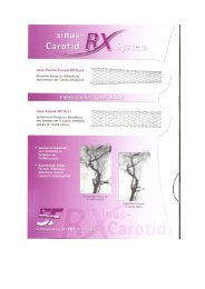 sinus-Carotid-Conical-RX Stent