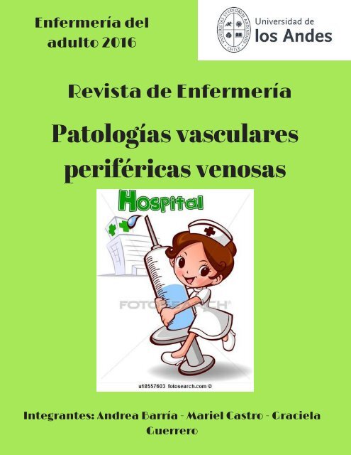 Alta definicion venas de safena ligadura