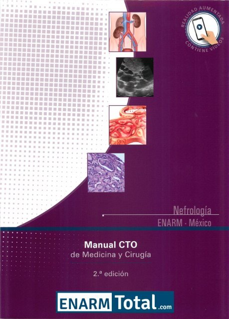dieta de diabetes colapso glomerulopatía