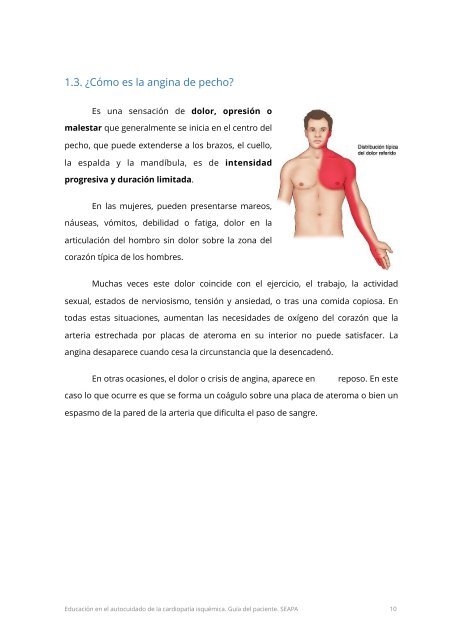 Educación en el autocuidado de la cardiopatía isquémica