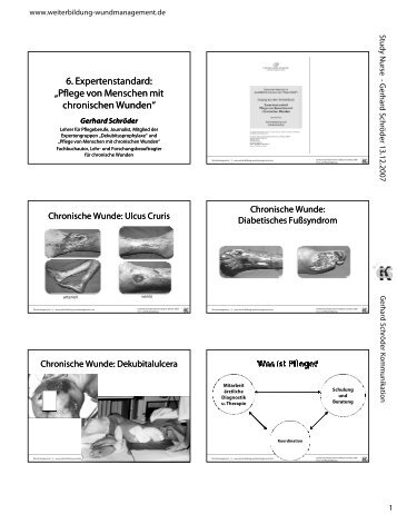 6. Expertenstandard: „Pflege von Menschen mit chronischen Wunden