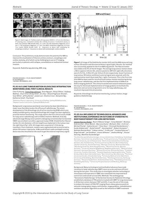 Journal Thoracic Oncology