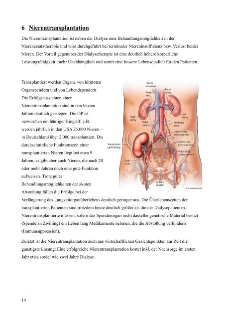 Die Pflegetheorie von Monika Krohwinkel am Beispiel der ...