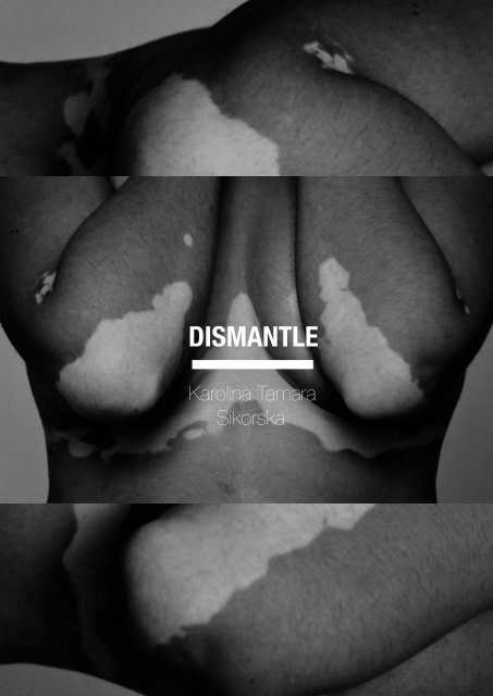 Dismantle