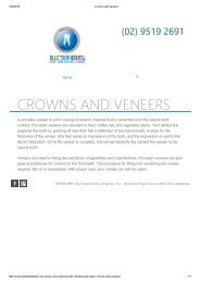 Crowns and Veneers