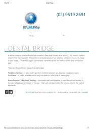 Dental Bridge