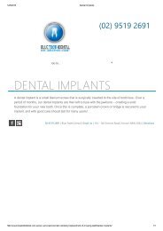 Dental Implants