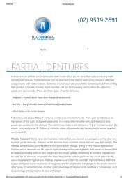 Partial Dentures