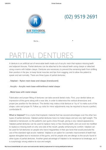 Partial Dentures