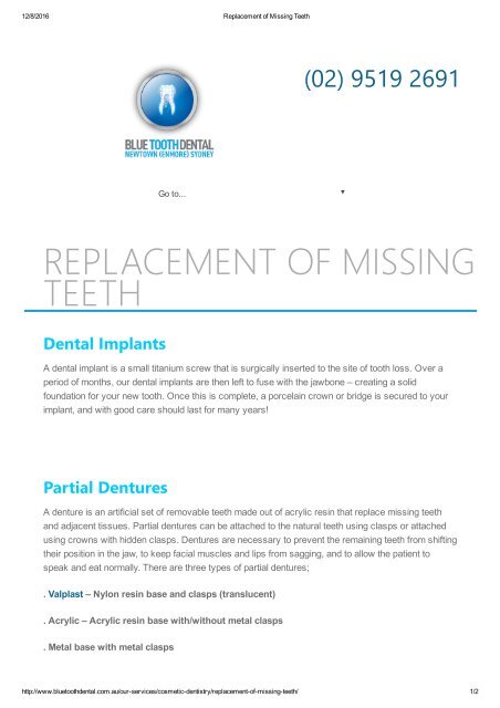Replacement of Missing Teeth