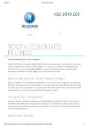 Tooth Coloured Fillings