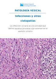 patologia-vesical-infecciones-cistopatias-v2