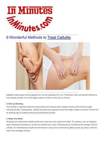 6 Wonderful Methods to Treat Cellulite