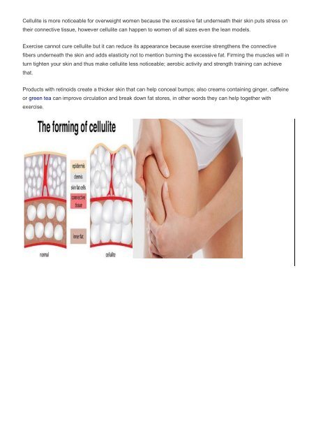 What are the real causes behind cellulite