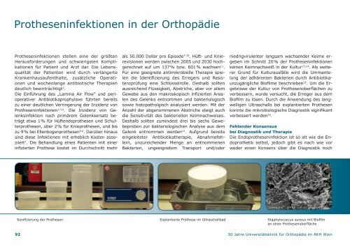 50 Jahre Universitätsklinik für Orthopädie im AKH Wien