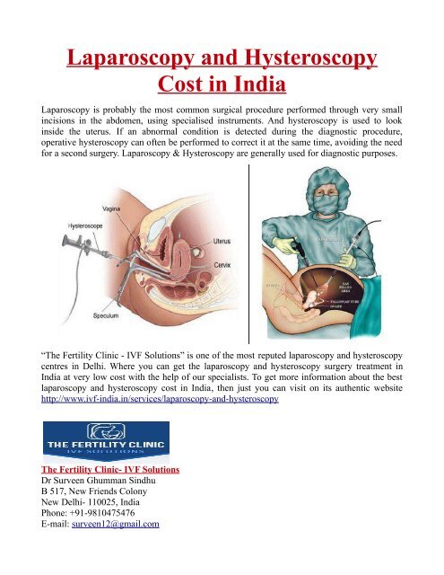 Laparoscopy and Hysteroscopy Cost in India