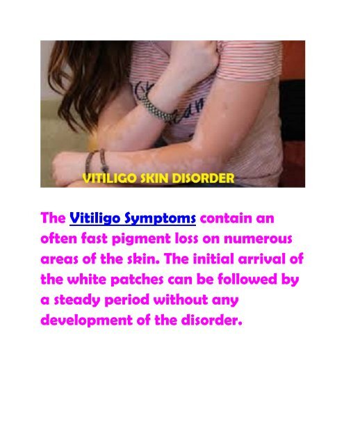Symptoms Diagnosis and Treatment of Vitiligo Skin Disorder
