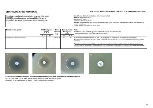 European Committee on Antimicrobial Susceptibility Testing