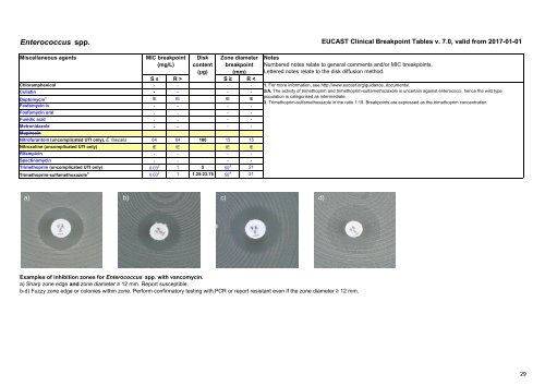 European Committee on Antimicrobial Susceptibility Testing