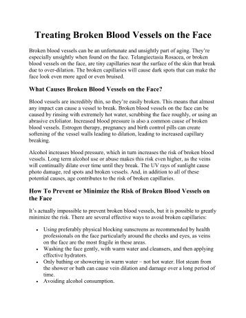 Treating Broken Blood Vessels on the Face