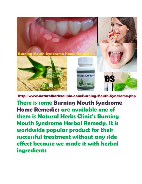 Burning Mouth Syndrome Home Remedies