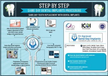 Step by step same day teeth replacement by dental implants procedure at Ahmedabad India