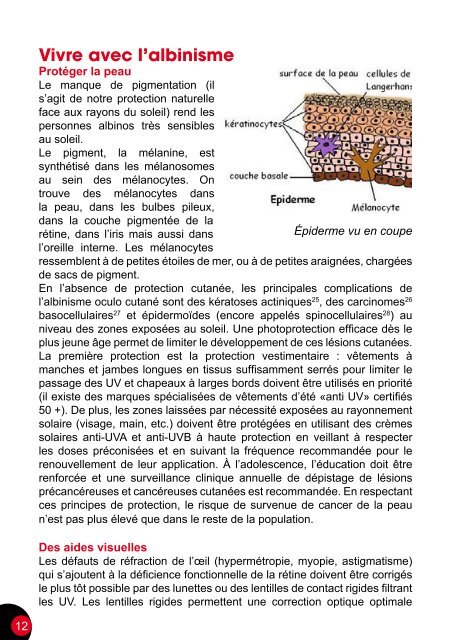 Albinisme-Condition-Genetique-2015