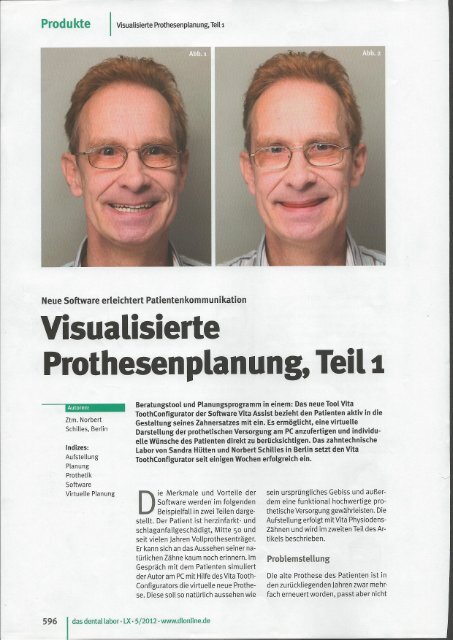 Visualisierte Prothesenplanung - Dentallabor Norbert Schilles