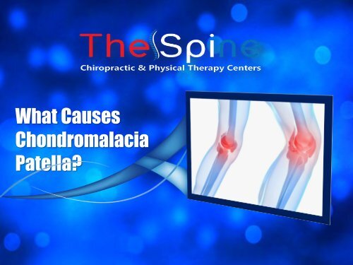 What Causes Chondromalacia Patella