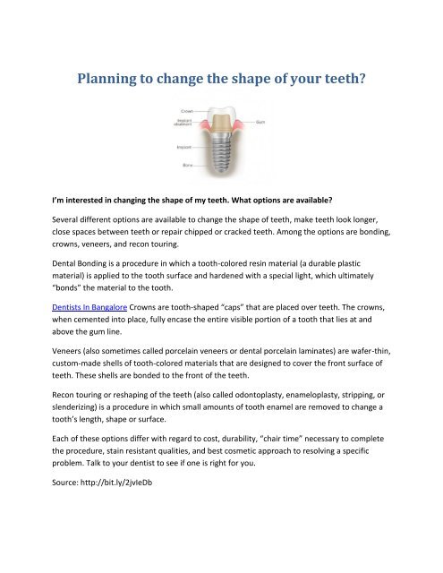 Dentists In Bangalore - Planning to change the shape of your teeth