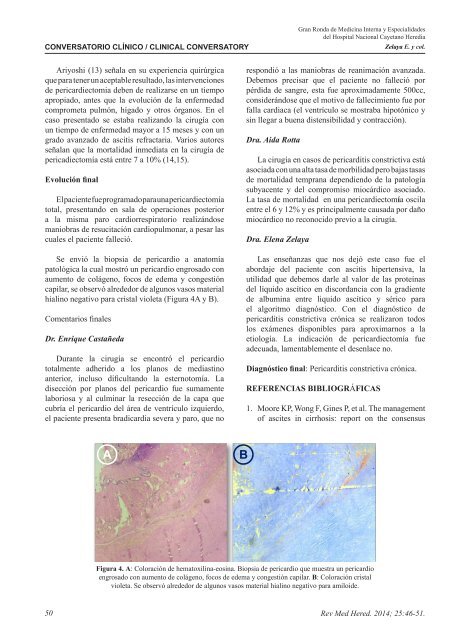 cirrosis hepatica