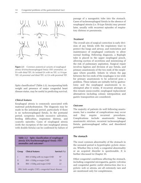 Helicobacter pylori - Portal Neonatal