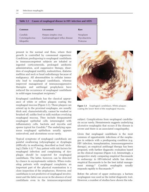 Helicobacter pylori - Portal Neonatal