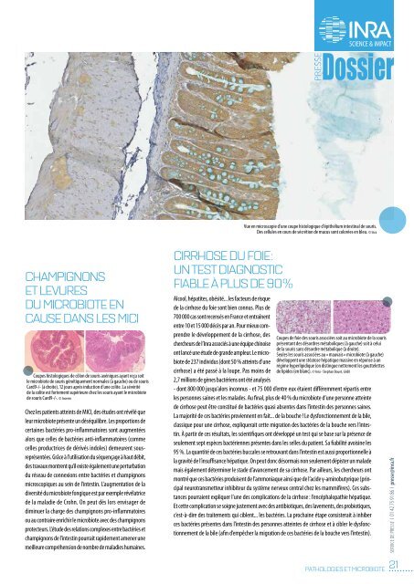 MICROBIOTE LA RÉVOLUTION INTESTINALE