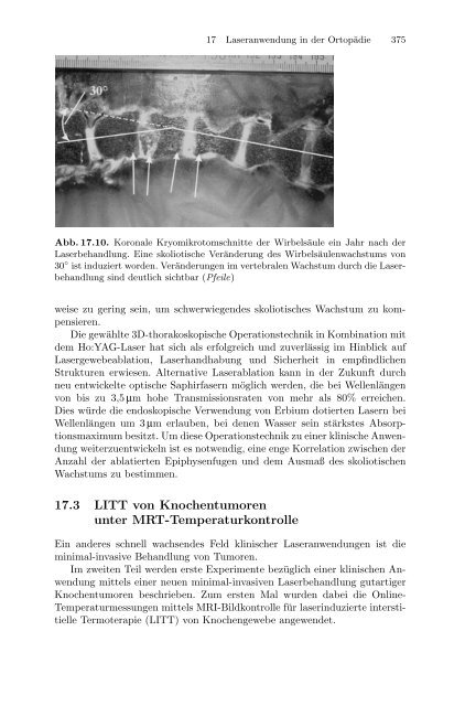 Medizinische Physik 3: Medizinische Laserphysik [2004]