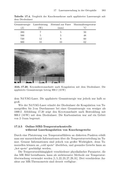 Medizinische Physik 3: Medizinische Laserphysik [2004]