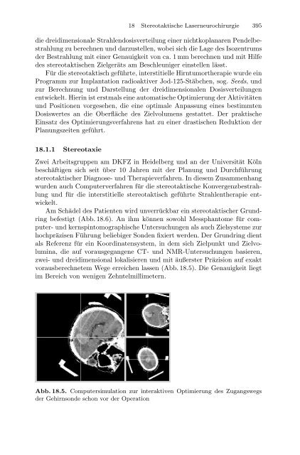 Medizinische Physik 3: Medizinische Laserphysik [2004]