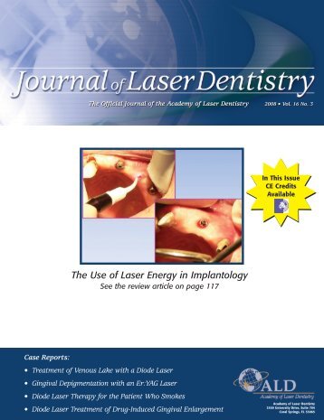The Use of Laser Energy in Implantology - Academy of Laser Dentistry