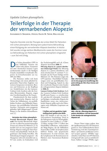 Update Lichen planopilaris - Dermatologische Praxis und ...