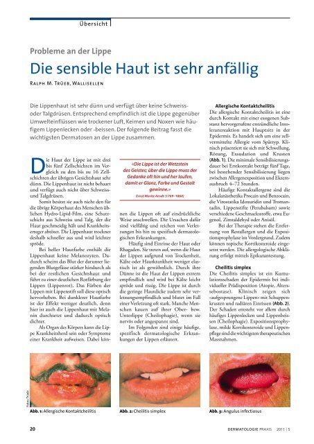 Die sensible Haut ist sehr anfällig - Dermatologische Praxis und ...