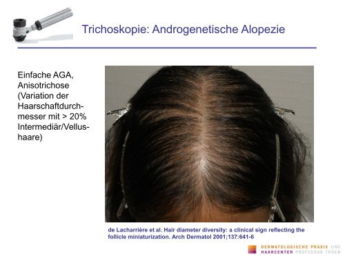 Infektionen der Kopfhaut und ihre Differentialdiagnose