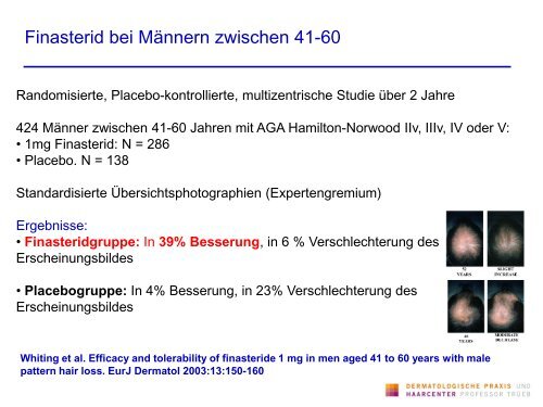 Infektionen der Kopfhaut und ihre Differentialdiagnose