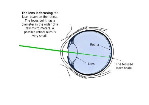 Can we make enemy soldiers blind using lasers?