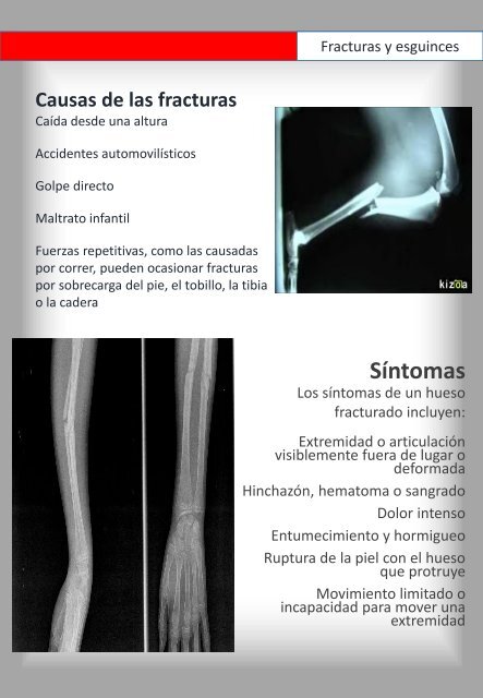 Lesiones deportivas